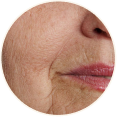 Anti-Aging