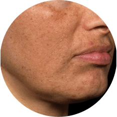 Daily Morning Pigmentation