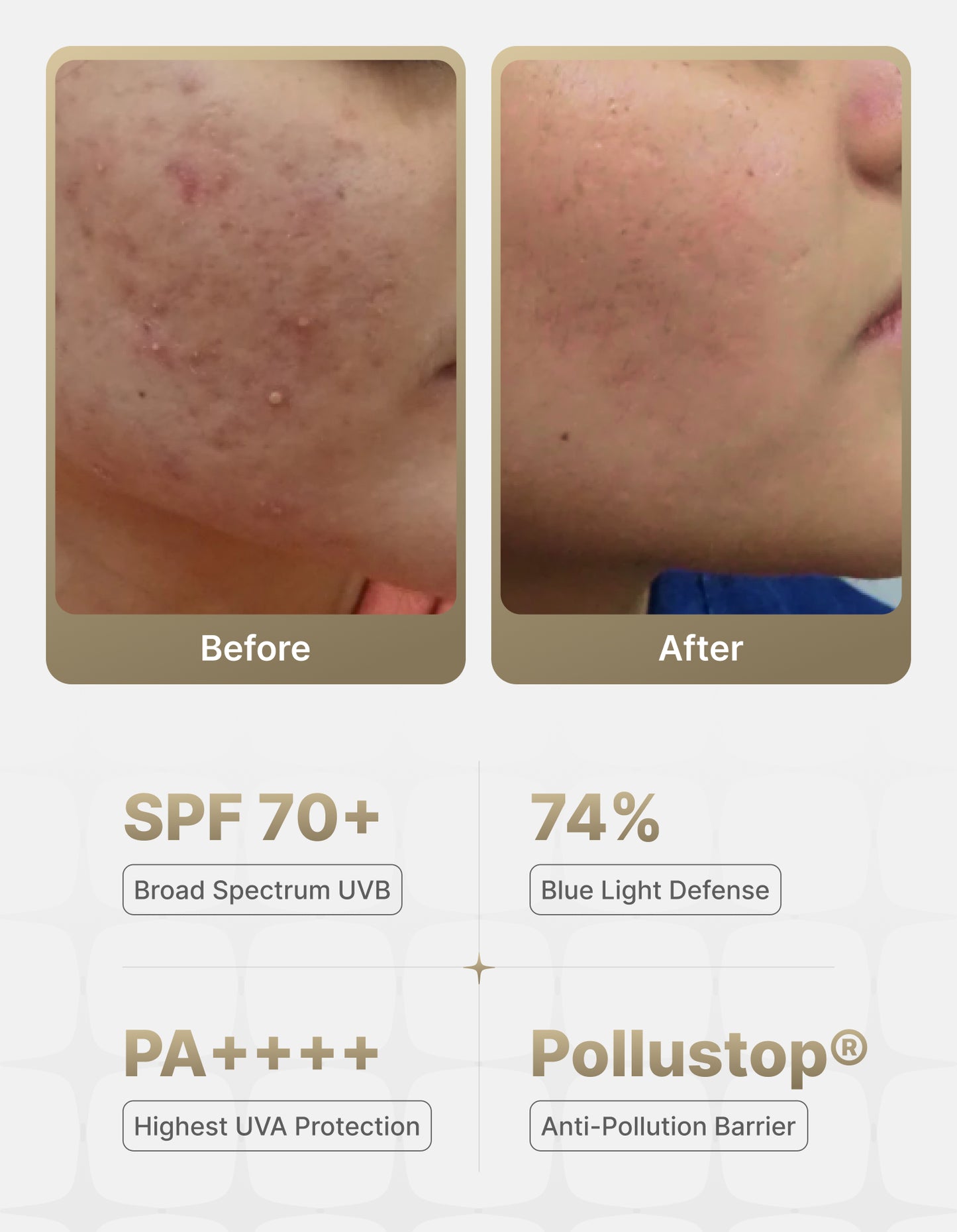 Encapsulated Sunscreen Gel Cream SPF 70+ | PA+++