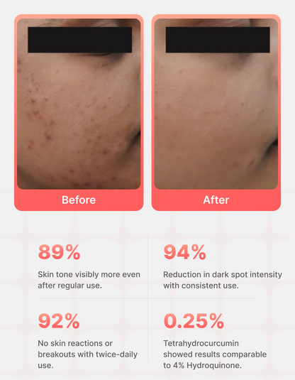 MelanoCorrect™ Spot Corrector Gel