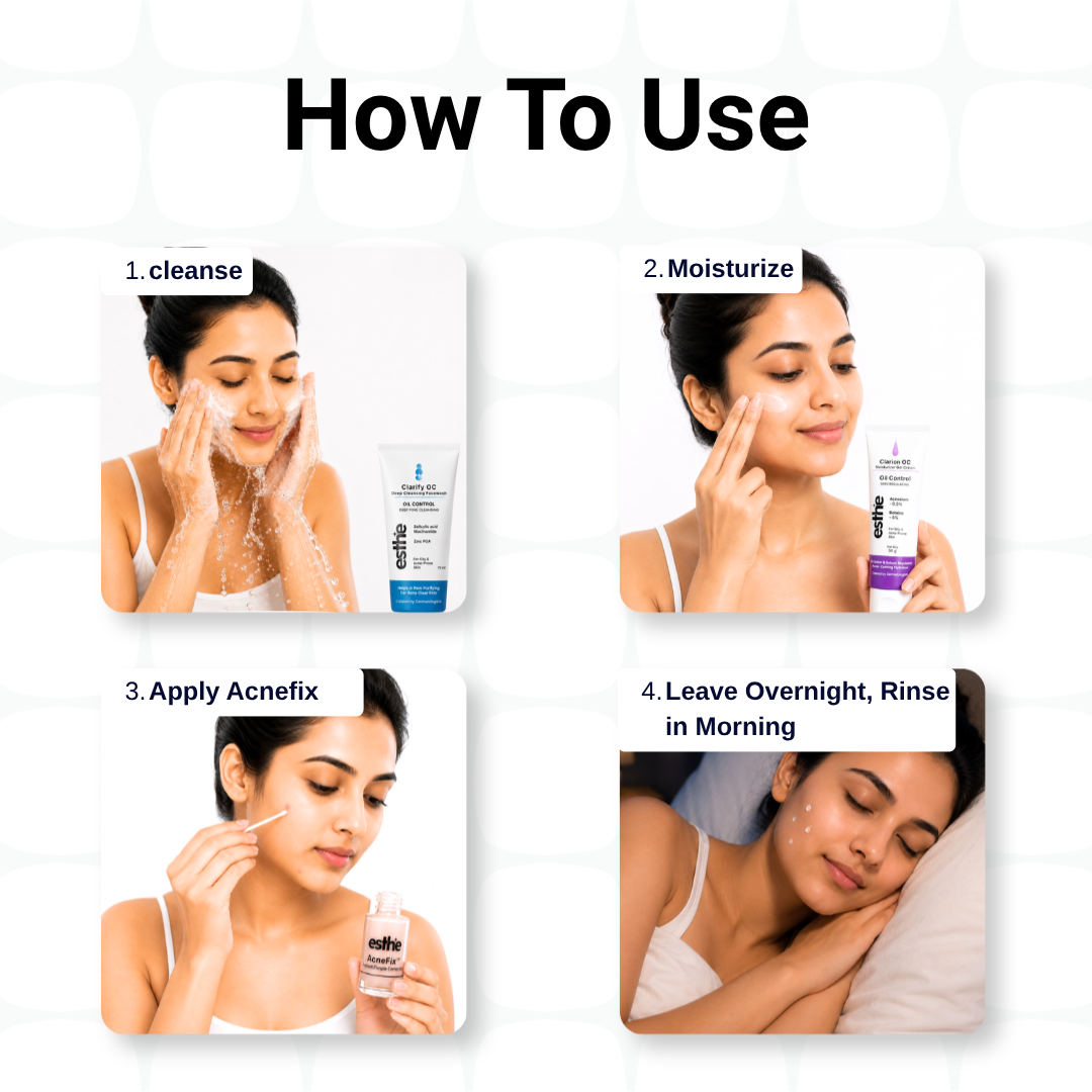 Clarion OC Moisturizer + Acne Fix instant Pimple Corrector + Clarify OC Deep Cleansing Facewash