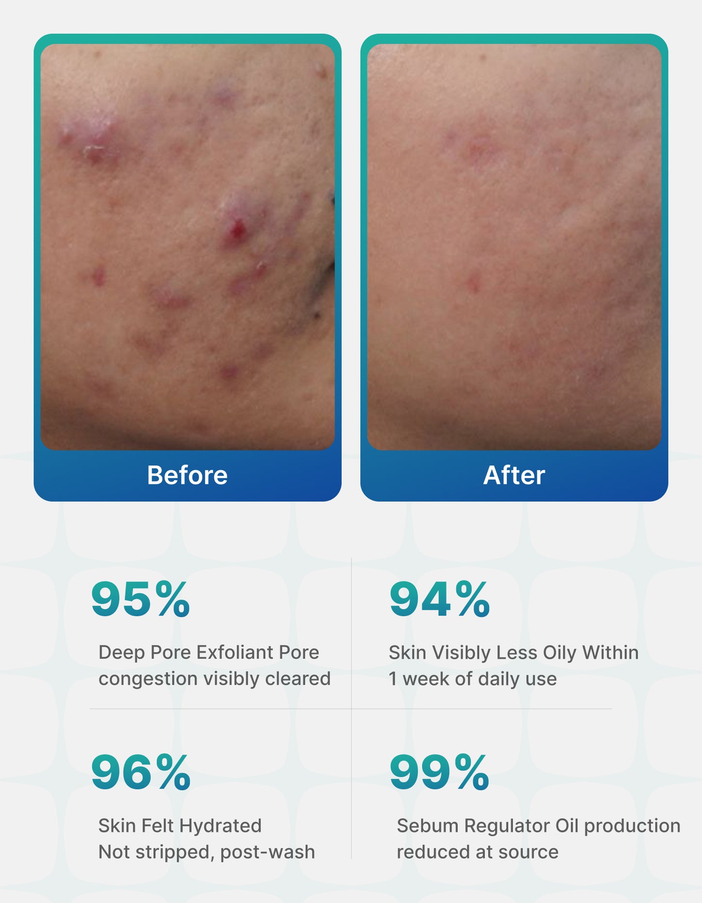 Clarify OC Deep Cleansing Facewash