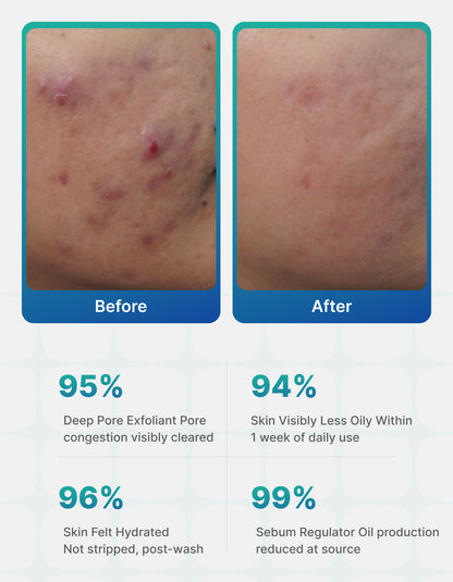 Clarify OC Deep Cleansing Facewash