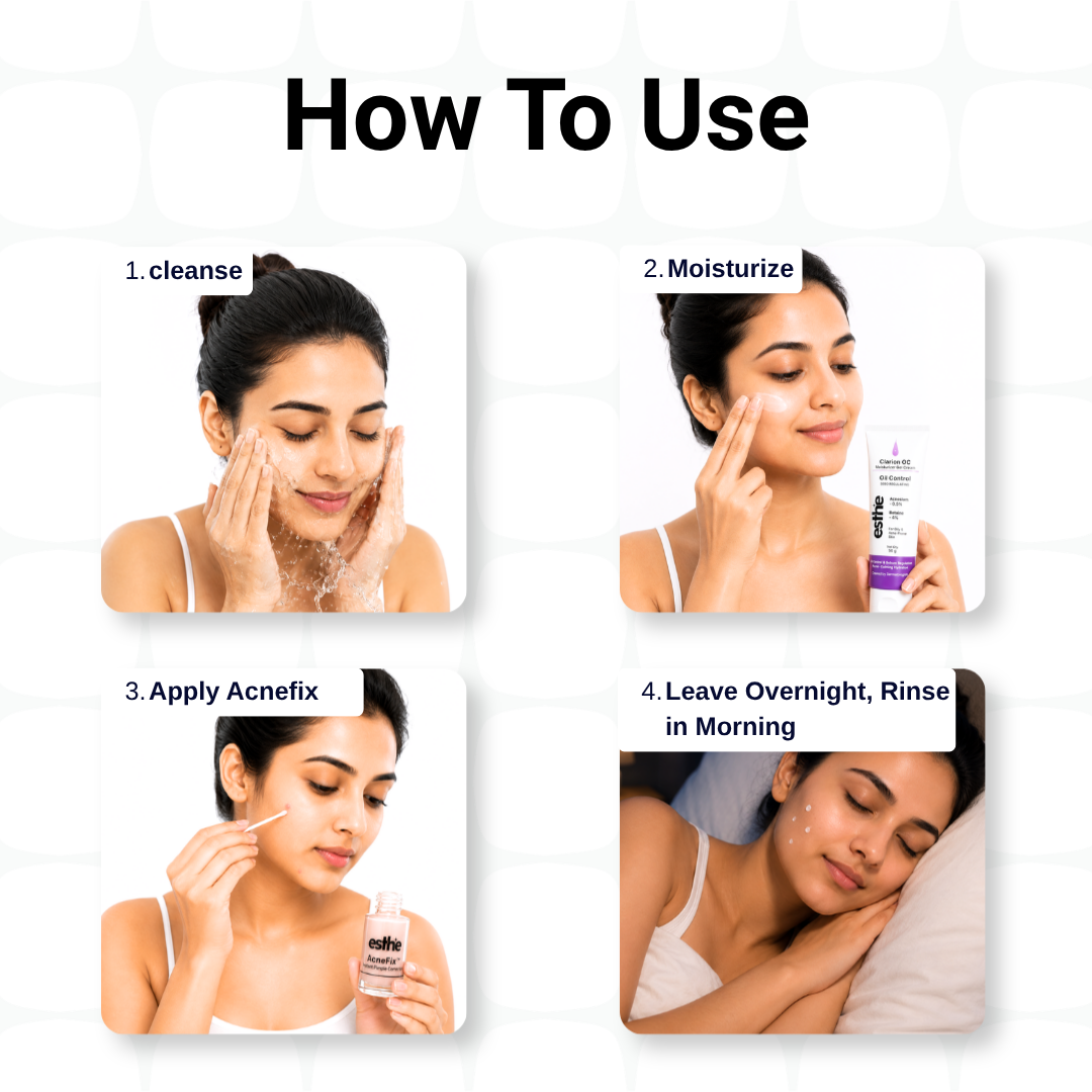 Clarion OC Moisturizer & AcneFix instant pimple Corrector Combo