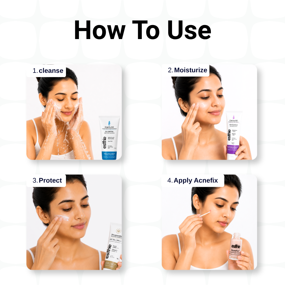 Clarion Oc Moisturizer + AcneFix Instant pimple corrector + Clarify Oc Deep Cleansing Facewash + Encapsulated Sunscreen Combo