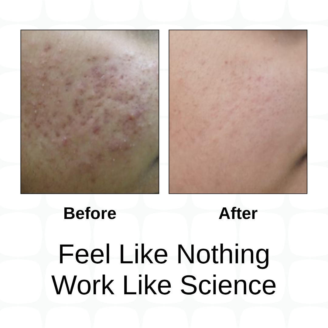 Encapsulated Sunscreen + Clarion OC Moisturizer Combo
