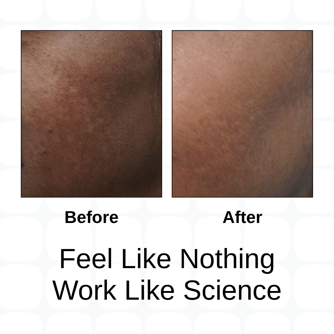 MultiBright Detan & Glow Facewash + MelanoCorrect™ Spot Corrector + Encapsulated Sunscreen Combo