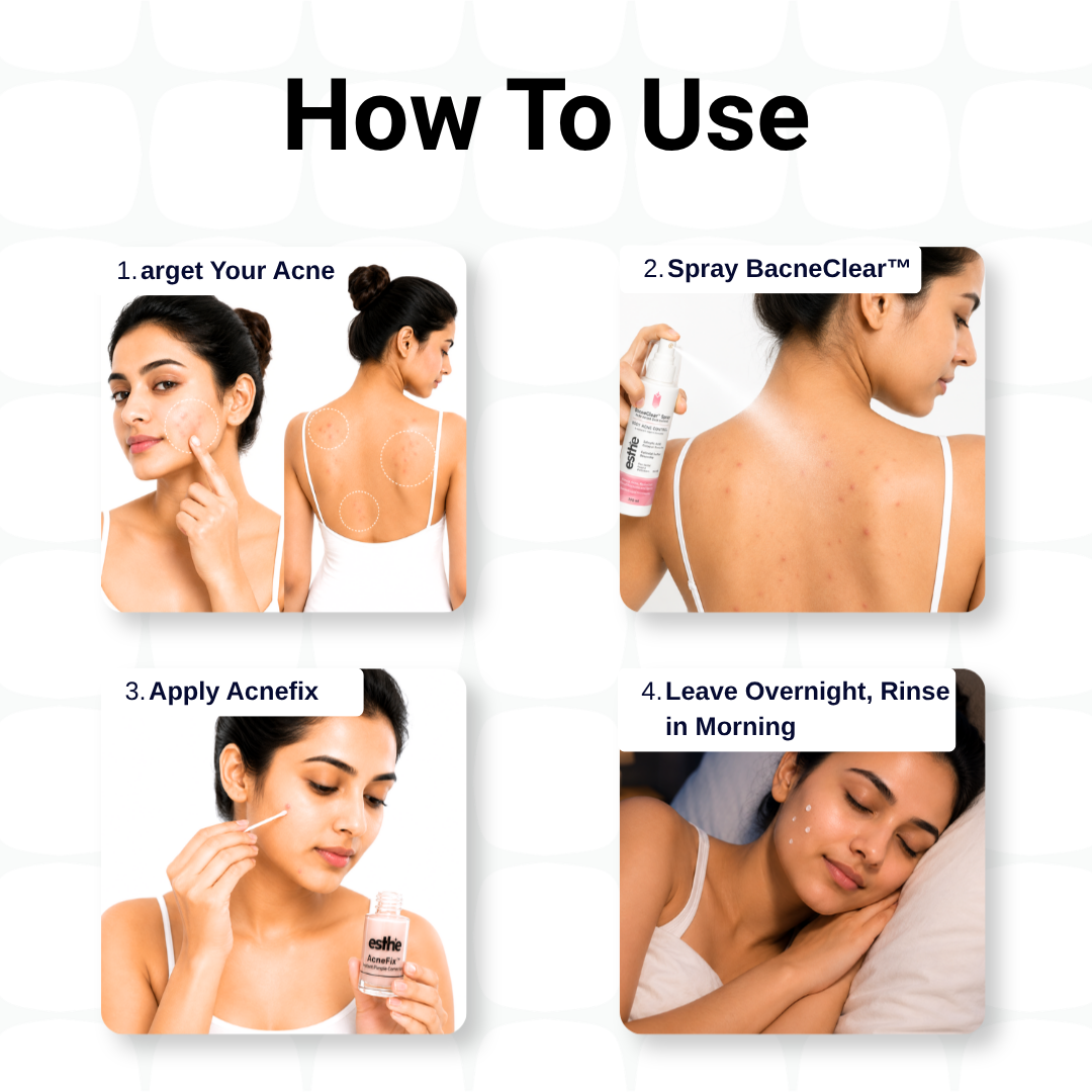 BacneClear Body Acne Spray + AcneFix Instant Pimple Corrector Combo