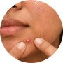 Said the pimple looked calmer by morning 