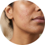 Noticed redness looked reduced by morning