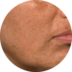 Combination Skin