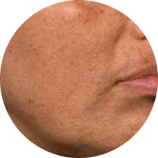 Combination Skin