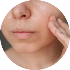 Oily Skin