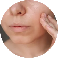 Oily Skin