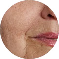 Anti-Ageing
