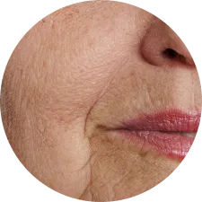 Anti-Ageing