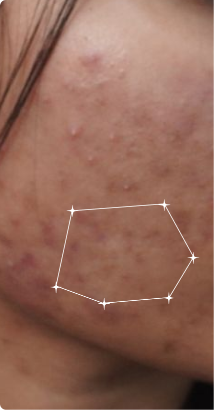Before — Sensitive Skin