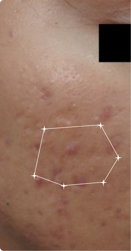 Before — Overnight Result