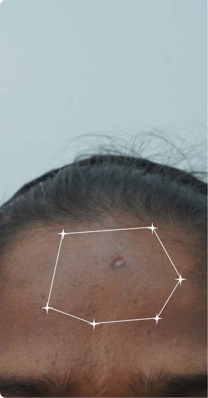 Before — Dull Skin