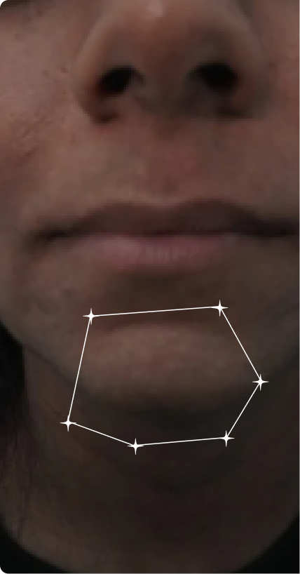 Before — Dull skin