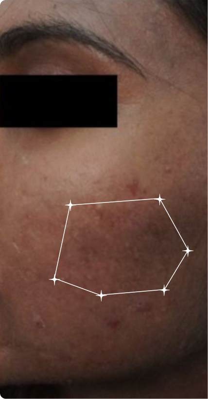 Before — Uneven Tone