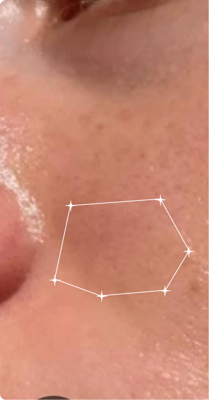 Before — Oily Skin