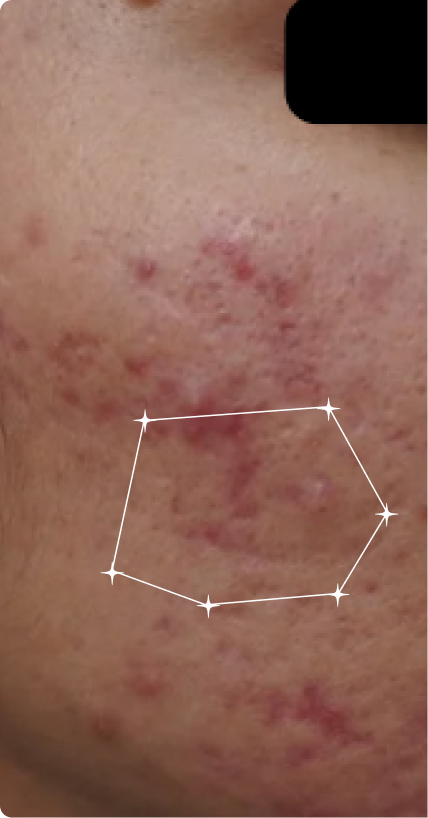 Before — Sensitive-Oily