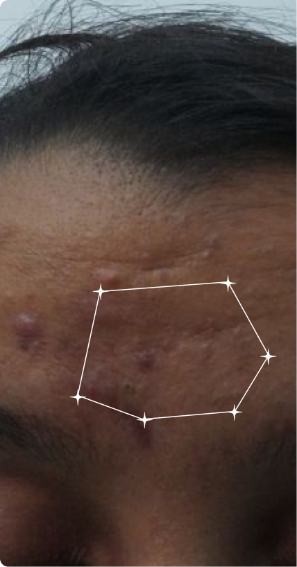 Before — Dark Spots