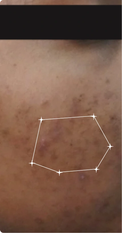 Before — Dull skin