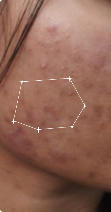 Before — Sensitive skin