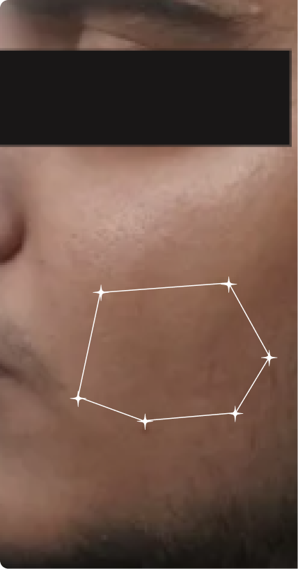 Before — Pigmentation