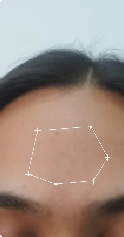 Before — Daily use