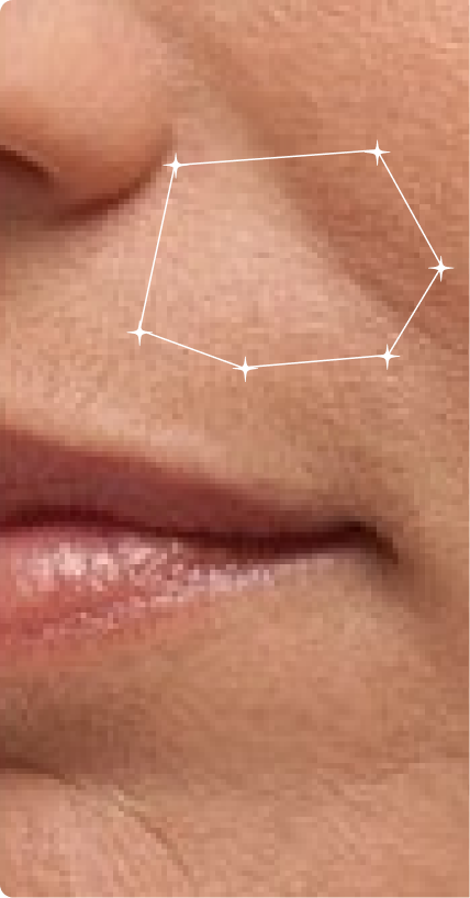 Before — Anti-Ageing