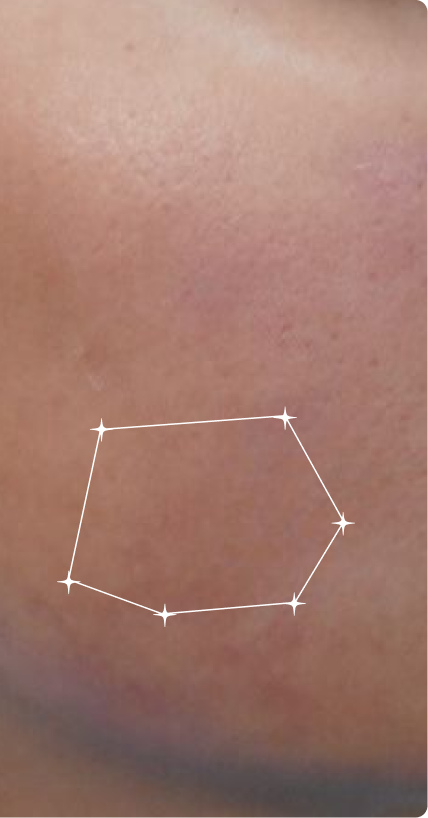 After — Sensitive Skin