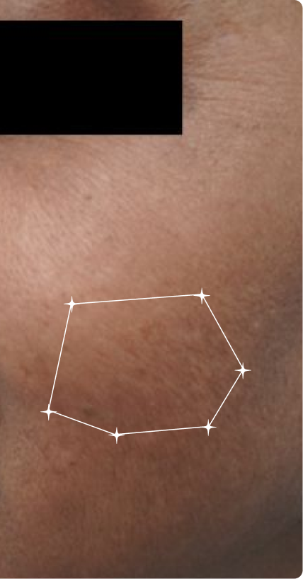 After — Tanning