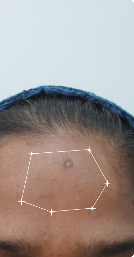 After — Dull Skin
