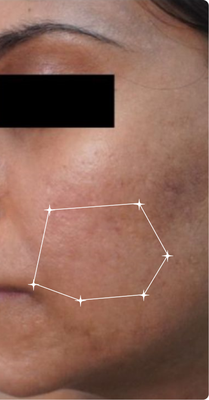 After — Uneven Tone