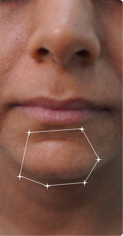 After — Dull skin