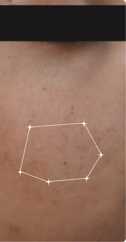 After — Dull skin