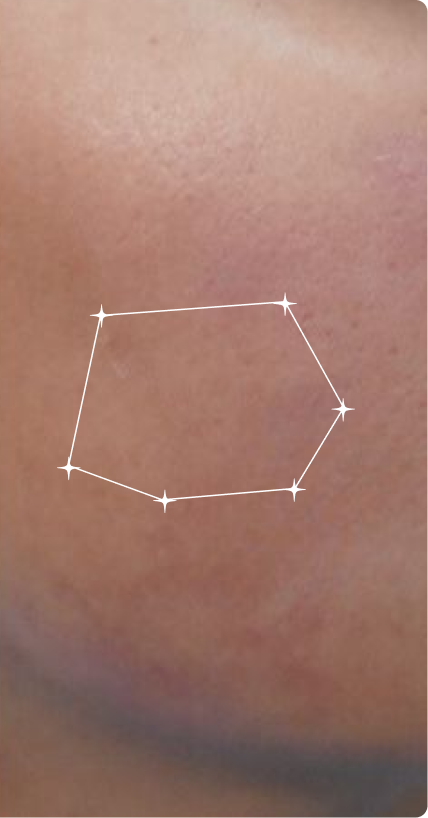 After — Sensitive skin