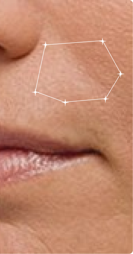 After — Anti-Ageing